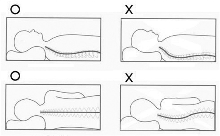 正确的睡姿或可预防颈椎病