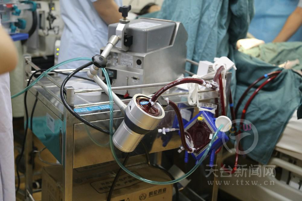 体外膜肺氧合(ecmo)治疗机