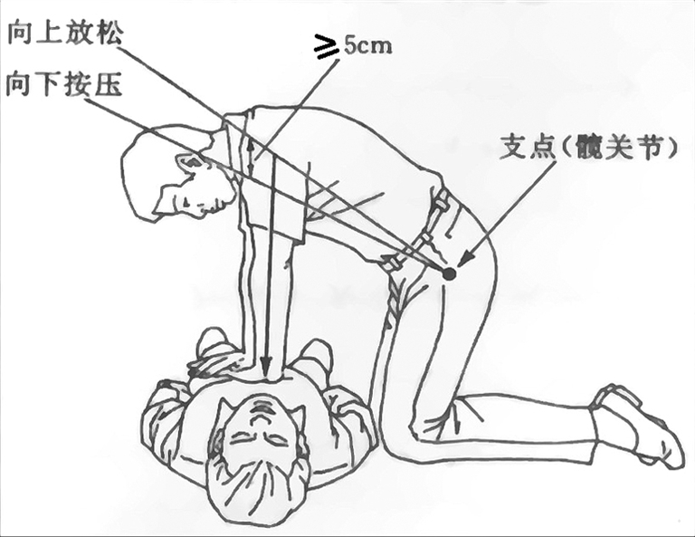 实施正确的心肺复苏很重要