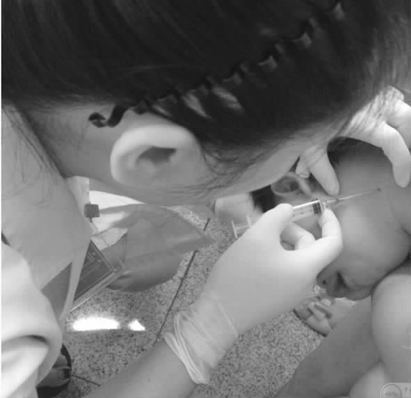 颈静脉采血不可怕